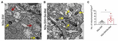 Selenomethionine Improves Mitochondrial Function by Upregulating Mitochondrial Selenoprotein in a Model of Alzheimer’s Disease
